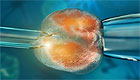 В больнице Барзилай пациентке ввели чужие эмбрионы