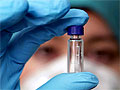 Ученые из Бразилии разработали вакцину против ВИЧ