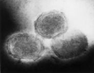 Вирус контагиозного моллюска